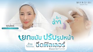 ยกขมับ ปรับรูปหน้า ด้วยโปรแกรมฉีดฟิลเลอร์  หมออาร์ตWansiri [upl. by Alihet]