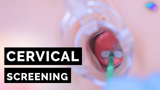 Cervical Screening Smear  HPV  OSCE Guide  UKMLA  CPSA [upl. by Sakiv]