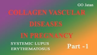 Collagen Vascular Diseases Part 1 [upl. by Adnaram]