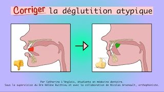 Corriger la déglutition atypique [upl. by Eibocaj642]