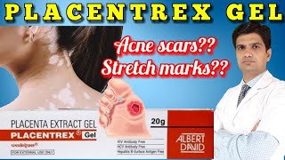 Placentrex gel  Placenta extract gel  Placentrex gel uses in hindi  LEARN ABOUT MEDICINE [upl. by Barb]