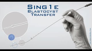 Embryo Transfer  Ultrasound Guided Embryo Transfer During ET  Embryo loading amp transferring [upl. by Sproul]