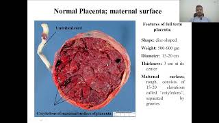 general embryology practical  placenta amp birth defect [upl. by Naihr]