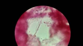 Biology Experiment  Rhizobium  The Nitrogen Fixing bacteria under Microscope [upl. by Enairda]