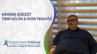 Kronik Sinüzit quotTıbbi Sülük ve Ozon Tedavisi quot [upl. by Eniluqaj]