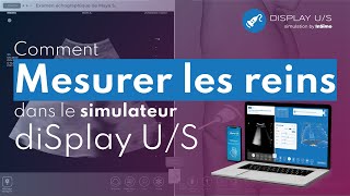 Comment mesurer le rein dans le simulateur déchographie diSplay US [upl. by Harad520]