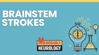 Brainstem Stroke Mnemonics Memorable Neurology Lecture 15 [upl. by Lindy]