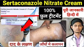 Sertaconazole nitrate cream 2 ww  sertaconazole cream  onabet cream kis kaam aati hai [upl. by Libbey978]