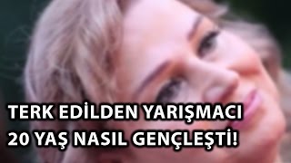 Eşi Tarafından Aldatılan Yarışmacı Model 20 Yaş Nasıl Gençleşti [upl. by Emsmus805]