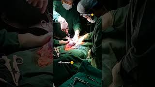 31 year old Interval debulking surgery😔🤲 caovarymedicalstudent doctor viralshort video 🙏🛐 [upl. by Salguod530]