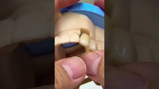 One implant dentist satisfying [upl. by Aneres]