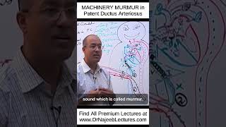 MACHINERY MURMUR In Patent Ductus Arteriosus shortvideo shorts drnajeeb lecture [upl. by Dreddy]