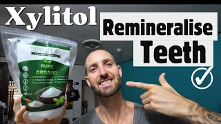 REMINERALISE Your TEETH With XYLITOL  How It Works [upl. by Annoeik609]