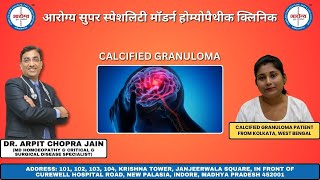 Calcified Granuloma Patient Treated By Dr Arpit Chopra Jain [upl. by Akinej]