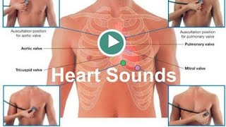 Heart Sounds S1S2S3and others [upl. by Fulks451]