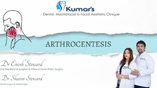 TMJ Arthrocentesis  TM Joint pain treatment in Vadodara  Dr Enosh Steward [upl. by Acisej]