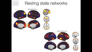 31 Resting State MultiSubject ICA and Dual Regression Rest E4 [upl. by Sihtam835]