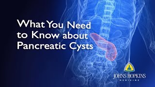 What You Need to Know About Pancreatic Cysts [upl. by Enehpets]