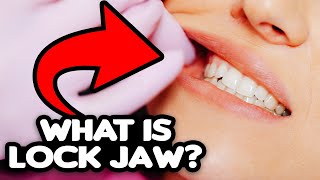 Lock Jaw Explained causes treatment prevention [upl. by Mozelle53]