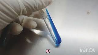 CITRATE test  Biochemicals in Microbiology  How to read [upl. by Pippy]