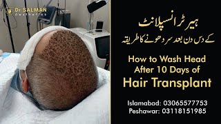 How to Wash Head After 10 Days of FUE Hair Transplant I Dr Salman Aesthetics Ihairwash fue [upl. by Hilel]