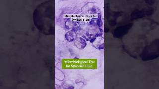 Microbiological Tests on Synovial Fluid medtech medtechstudent shortvideos synovialfluid fypシ゚ [upl. by Schinica]