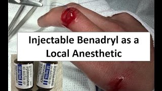 Injectable Benadryl as a Local Anesthetic [upl. by Lynnworth]