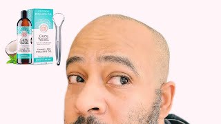 Oil Pulling Review Warning Real Results [upl. by Aitram]