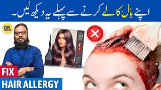 Hair Dye Allergy Ka Ilaj  Kizab LaganaBaal Kale Karne Ke Nuksan  Dr Ibrahim [upl. by Fransisco258]