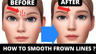 FACE YOGA FOR FROWN LINES  GET RID OF FROWN LINES [upl. by Liag]