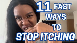 How to STOP Itching Dyshidrotic ECZEMA at Night 11 FAST Remedies [upl. by Gasparo]