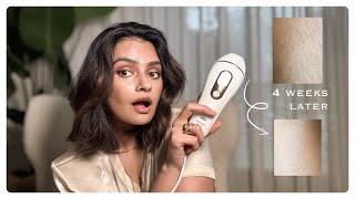 IPL Hair Removal At Home with Braun What I think 15 years later [upl. by Suiratnauq]