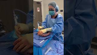 Laparoscopic sleeve gastrectomy of Bariatric surgery [upl. by Direj]