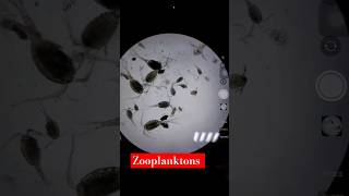 Identification of Zooplankton 😍 under Microscope🔬 plankton shorts aquaculture farming ytshorts [upl. by Medovich]