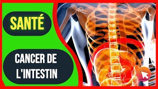 17 Symptômes du CANCER DE LINTESTIN [upl. by Llednar]