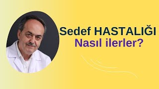 Sedef hastalığığının oluşum aşamaları nasıldır  DrÇetin Öngöre sedefhastalığı romatizma alerji [upl. by Nylhtak]