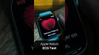 Apple Watch ECG Test  Watch Series 9 ECG Apple WatchSeries9 [upl. by Addison]