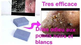 Comment faire un savon anti points noirs blancs comédons saletés du visage [upl. by Atled]