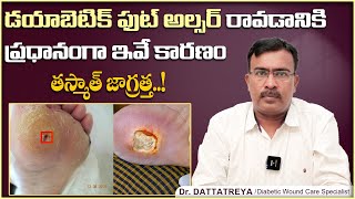 Diabetic Foot Ulcers Causes and Treatment  Sensory Neuropathy Symptoms  Health Tips  Vikram Tv [upl. by Sadnak84]