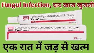 Tyza Cream Uses  Terbinafine Cream  दाद खाज खुजली Fungul Infection जड़ से ठीक करे [upl. by Niwdog]