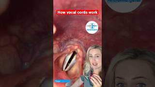 The Surprising Solution to Vocal Fold Nodules  Therapy First [upl. by Melda]