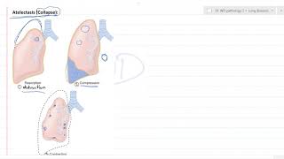 Lungs pathology 2 congenital anomalies [upl. by Rachael]