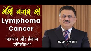 लिम्फोमा कैंसर ।मेरी नज़र से । एपिसोड 11 । डॉ जमाल ए खान  Lymphoma Cancer [upl. by Ahse]