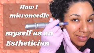 Microneedling  how to microneedle at home with Dr Pen  esthetician does microneedling [upl. by Martynne]