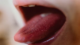 10 Common HIV Symptoms In Women That You Shouldnt Ignore [upl. by Adnoluy377]