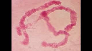 Polytänchromosomen  Riesenchromosomen  Überblick [upl. by Theo11]