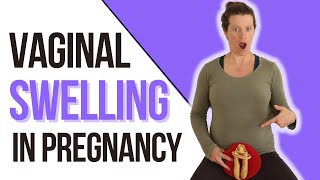 Eliminate VAGINAL SWELLING during pregnancy [upl. by Smart246]