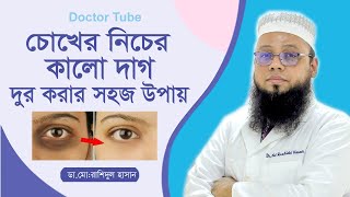 চোখের নিচের কালো দাগ দূর করার উপায়  Bangla Tips Remove dark spots  Choker Kalo Dag Dur Kora upay [upl. by Dominga]