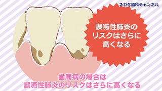 【高松市健康歯医者】歯周病対策は誤嚥性肺炎予防策でもある！スガタ歯科チャンネル237（口腔ケアチャンネル） [upl. by Oibaf]