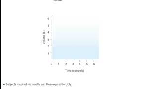 FVC and FEV1 in Normal Subjects [upl. by Liag]